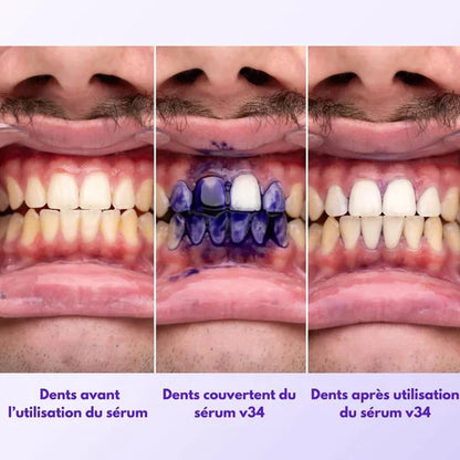 Sérum Blanchissant V34